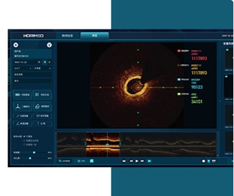 恒宇醫(yī)療OCT系統(tǒng)醫(yī)療影像軟件界面設(shè)計